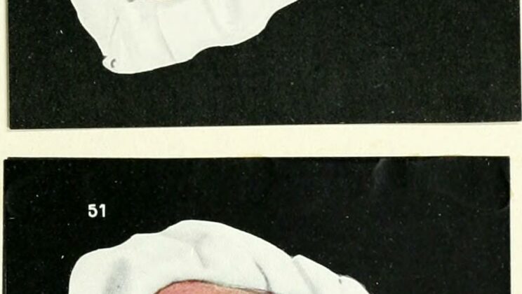 Chistes de Dentistas: Para Reírse del Sillón