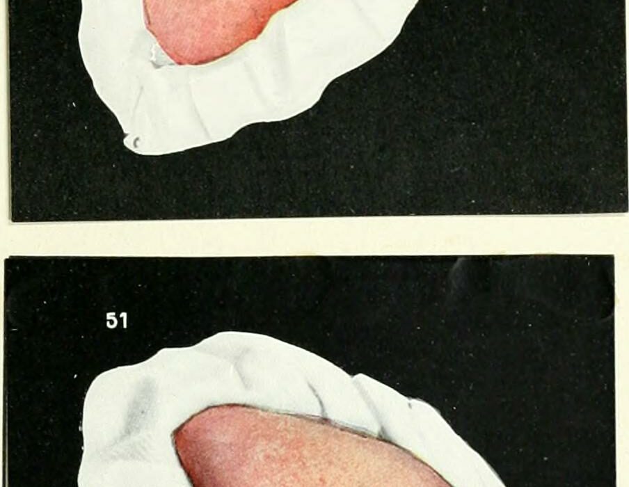 dentist dental examination